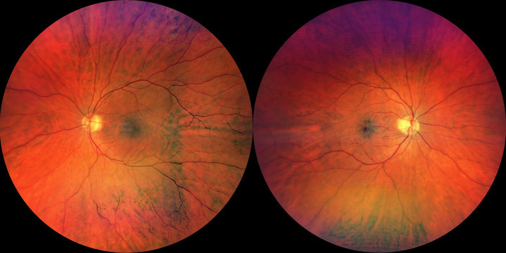 Dual Fundus Image